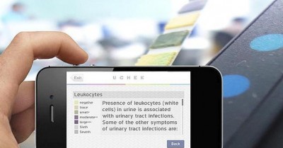 uCheck, aplicacion para analizar la orina